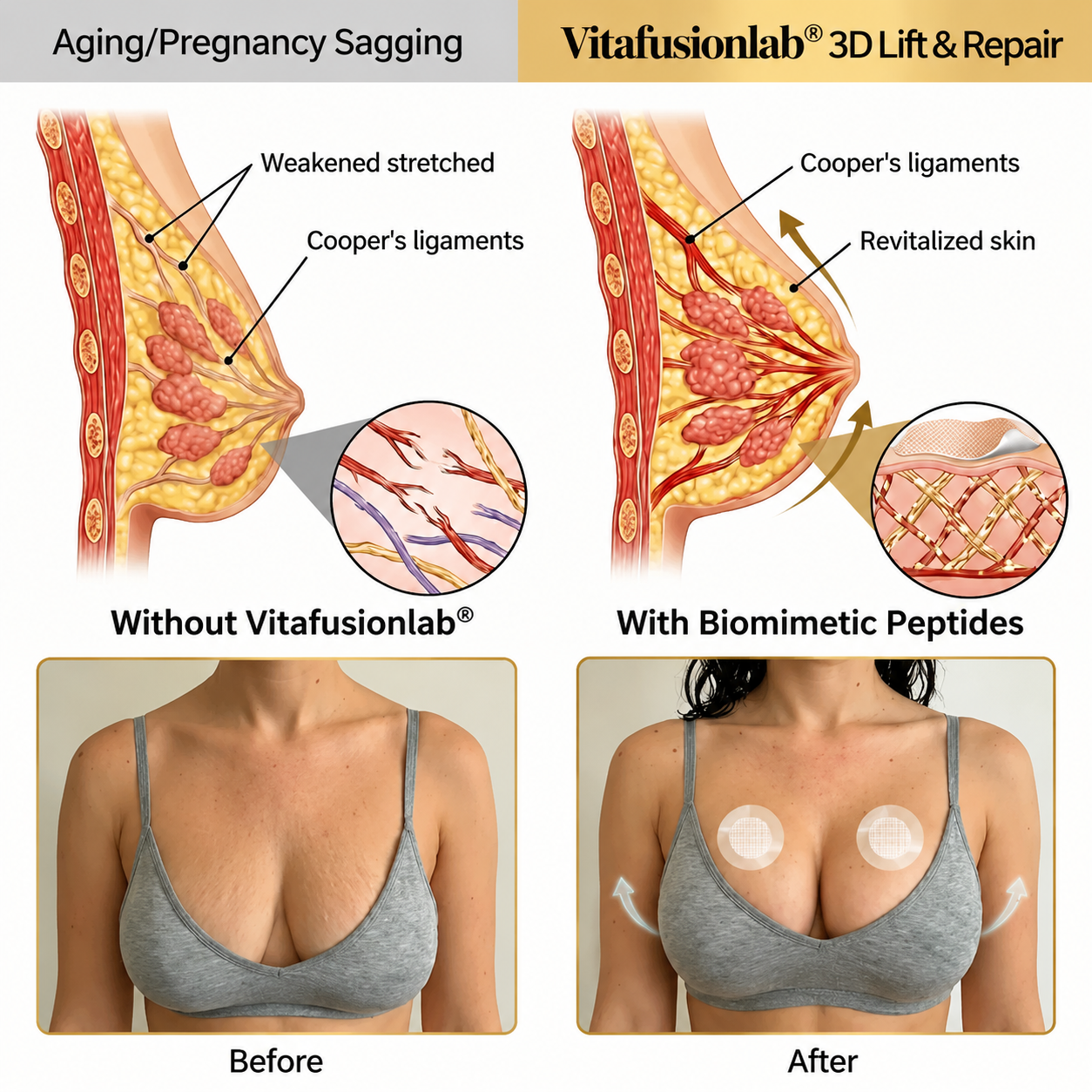 🔥Limited-time 60% sale--Vitafusionlab Targeted Breast Enhancement Advanced Nano-Microneedle Patches